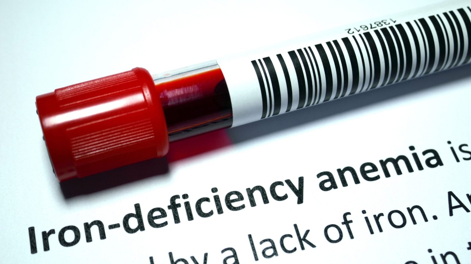 Image showing a blood sample being tested for iron deficiency anemia.