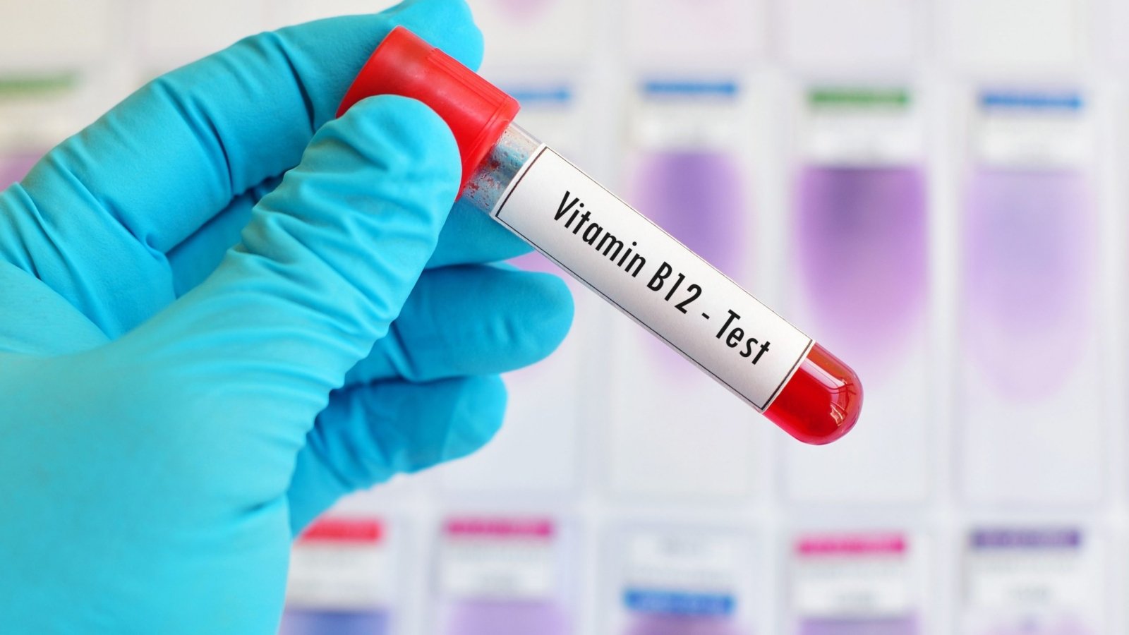 Image of a blood sample being tested for Vitamin B12 deficiency.