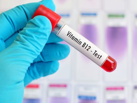 Image of a blood sample being tested for Vitamin B12 deficiency.