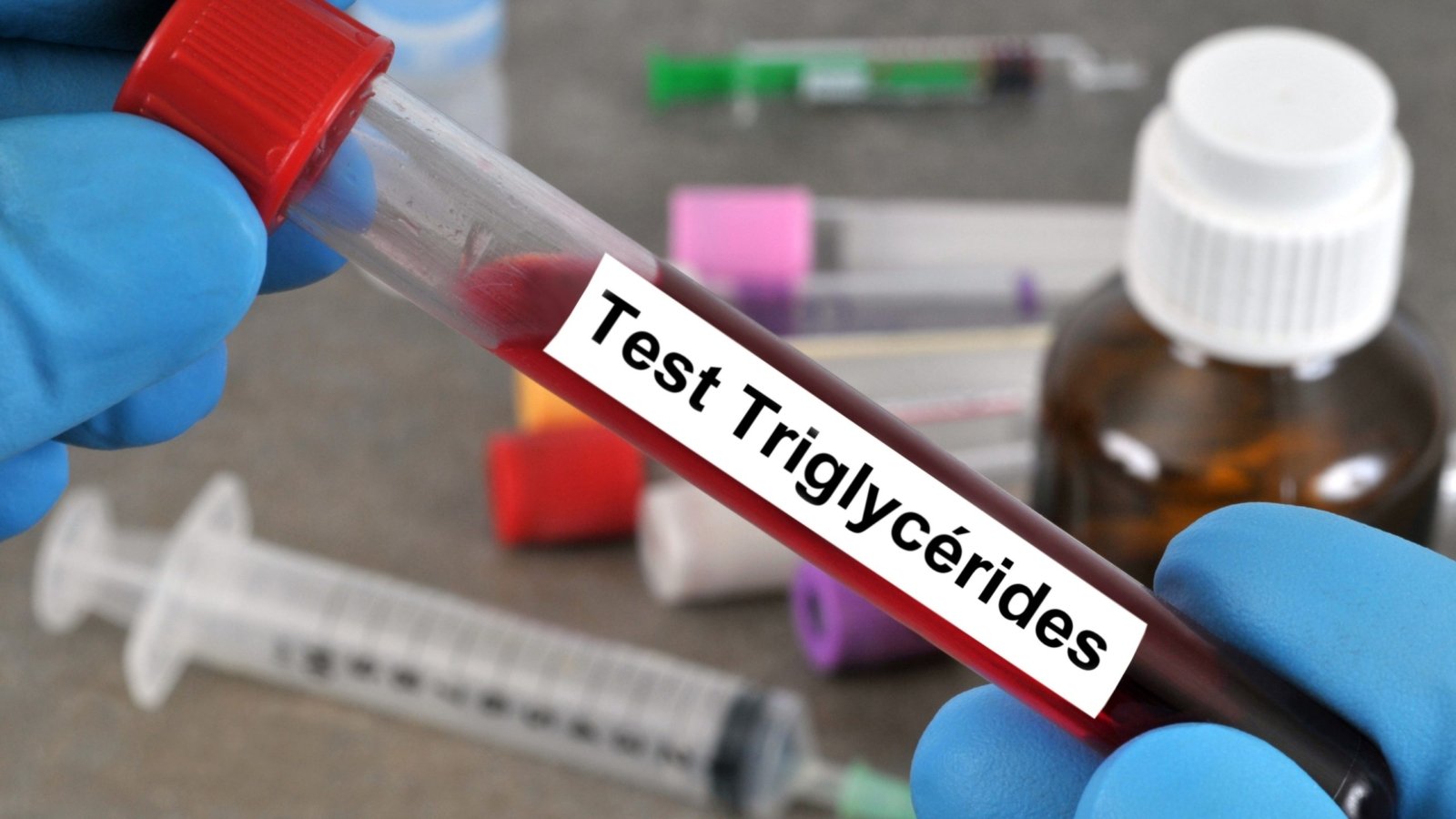 An image showing a blood sample being tested for high triglycerides.