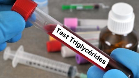 An image showing a blood sample being tested for high triglycerides.