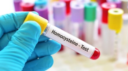 An image showing a blood sample being tested for homocysteine levels.