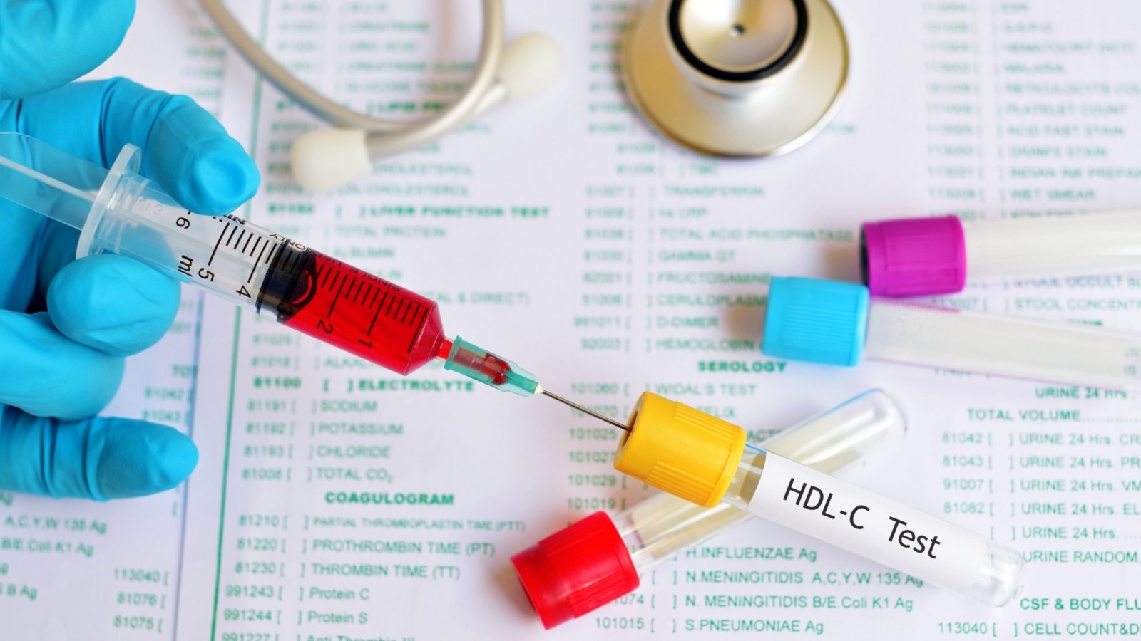 An image of a blood sample being tested for HDL cholesterol, also known as good cholesterol.