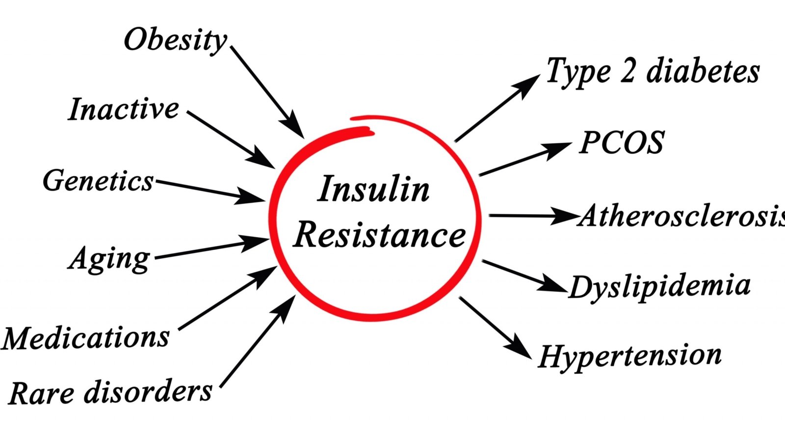 Causes and risk factors of Insulin Resistance.